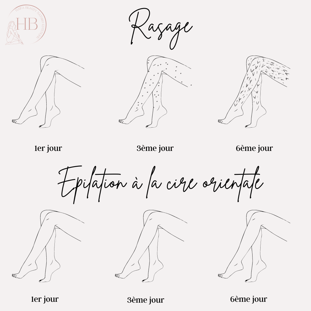 REPOUSSE DES POILS A L'EPILATION ORIENTALE