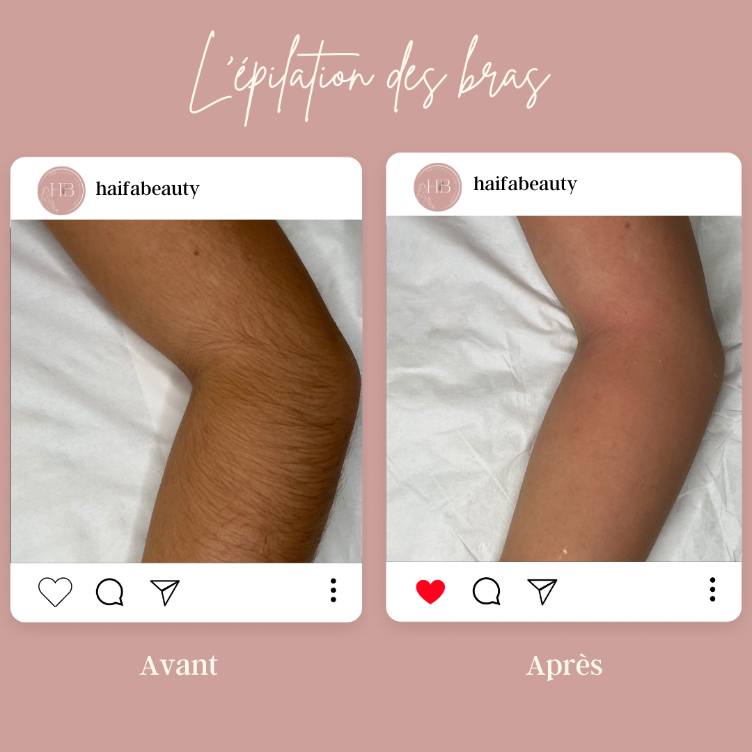 EPILATION ORIENTALE DES BRAS