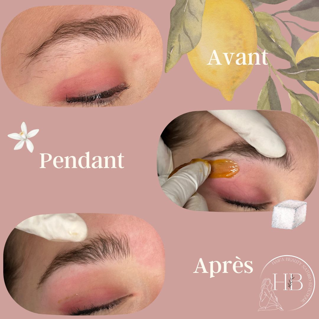 epilation sourcils